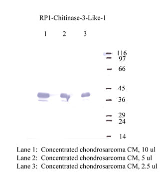 Chitinase-3-Like-1