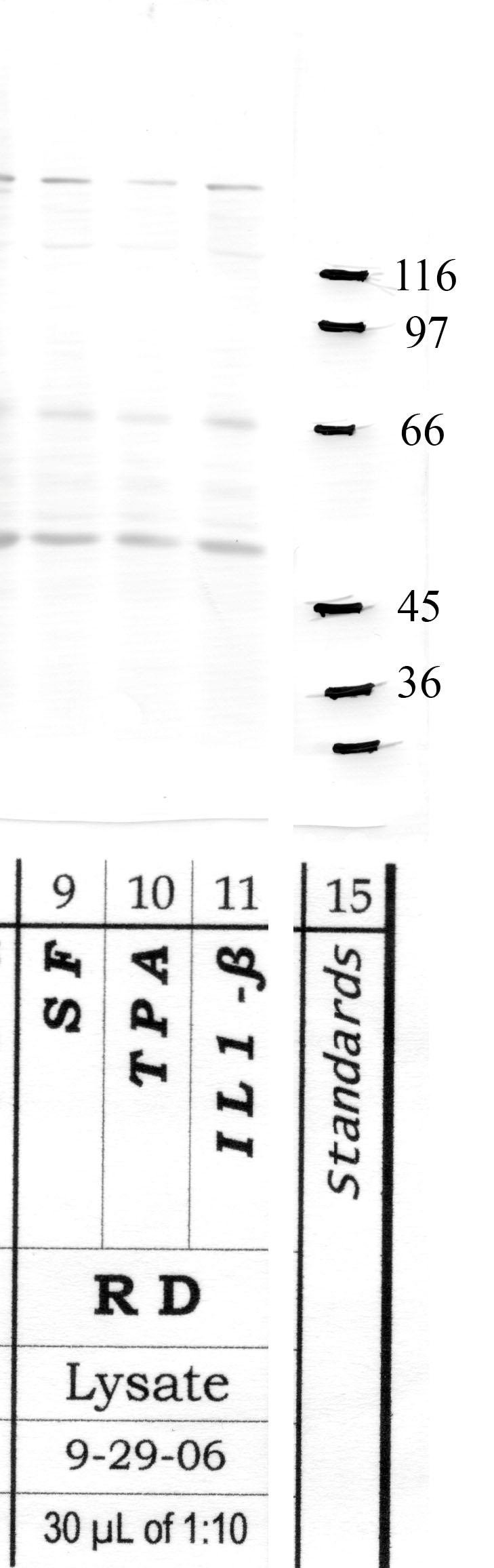 Calpain-15