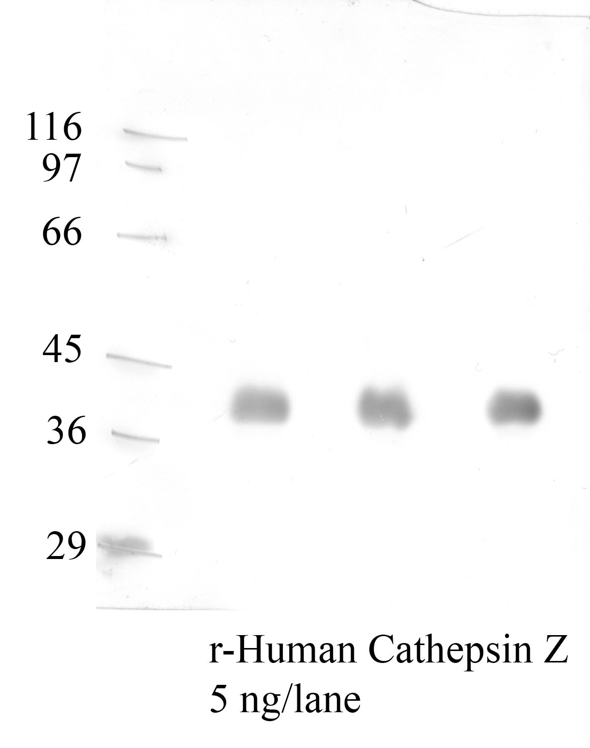 Cathepsin-Z