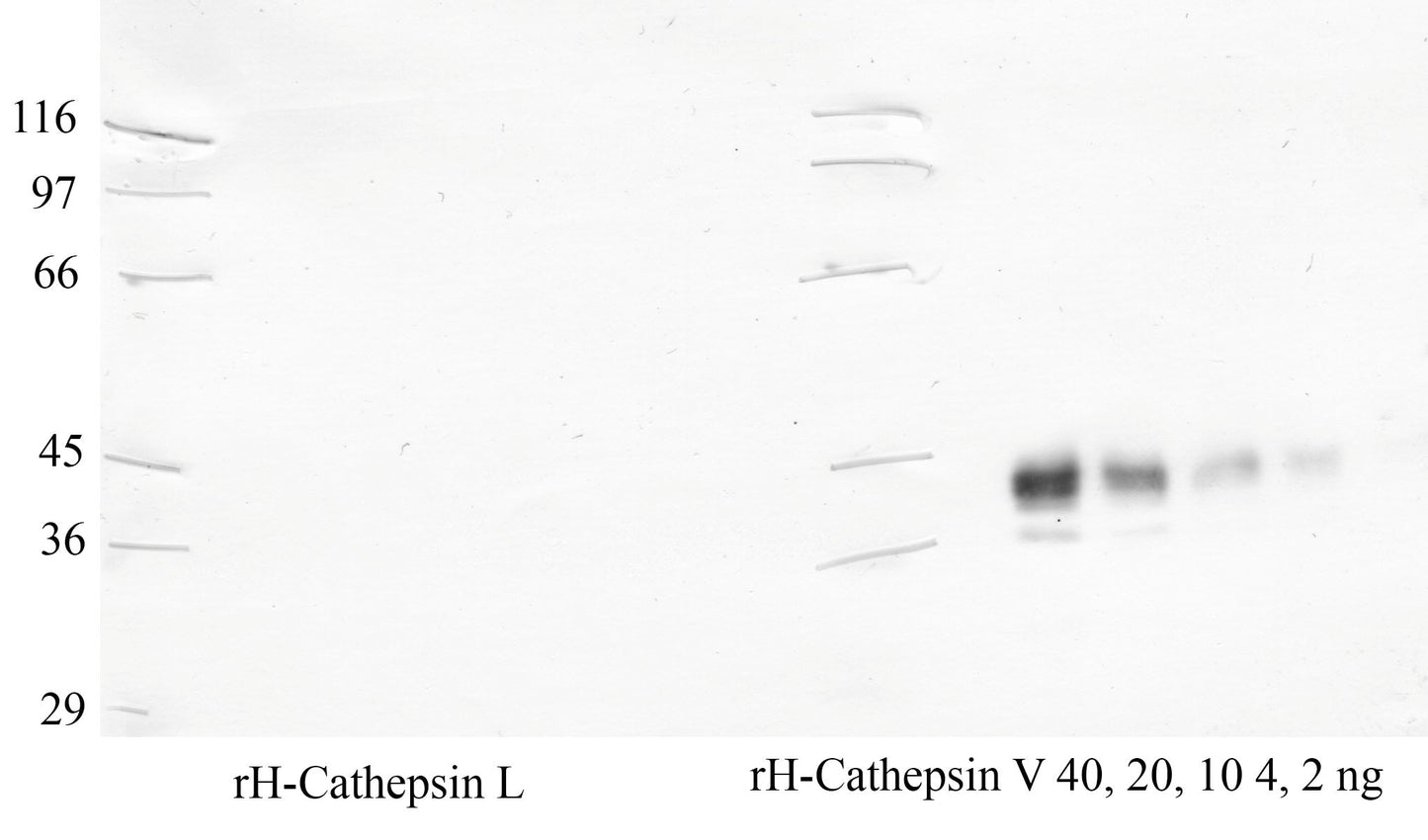 Cathepsin-V