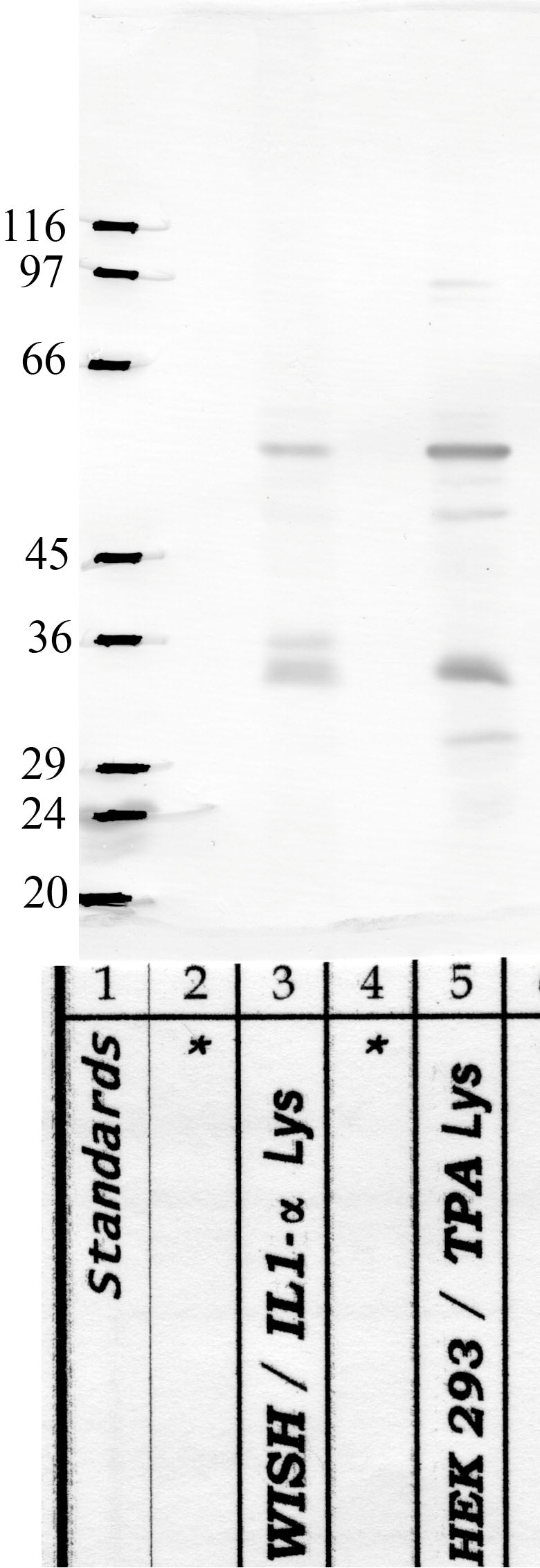 Serpin-B7