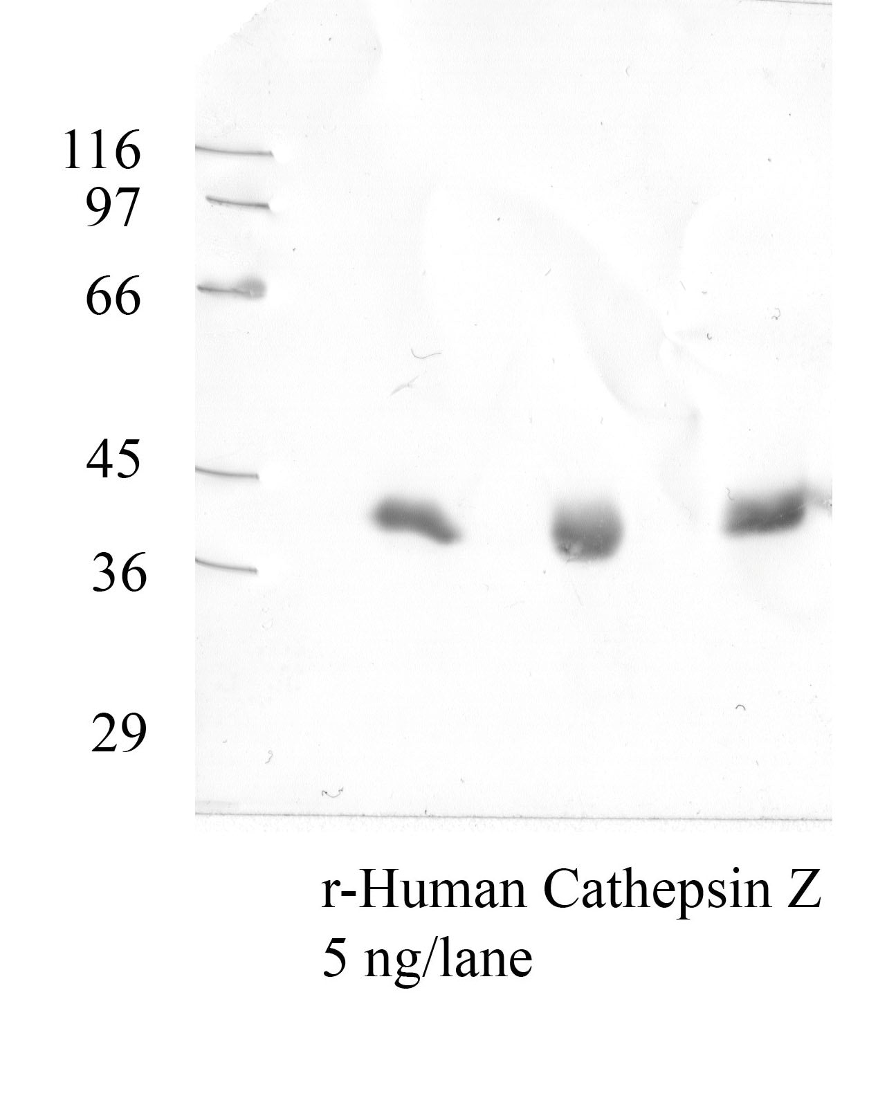 Cathepsin-Z