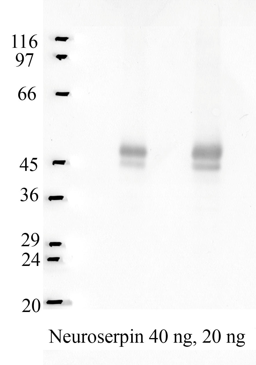 Neuroserpin