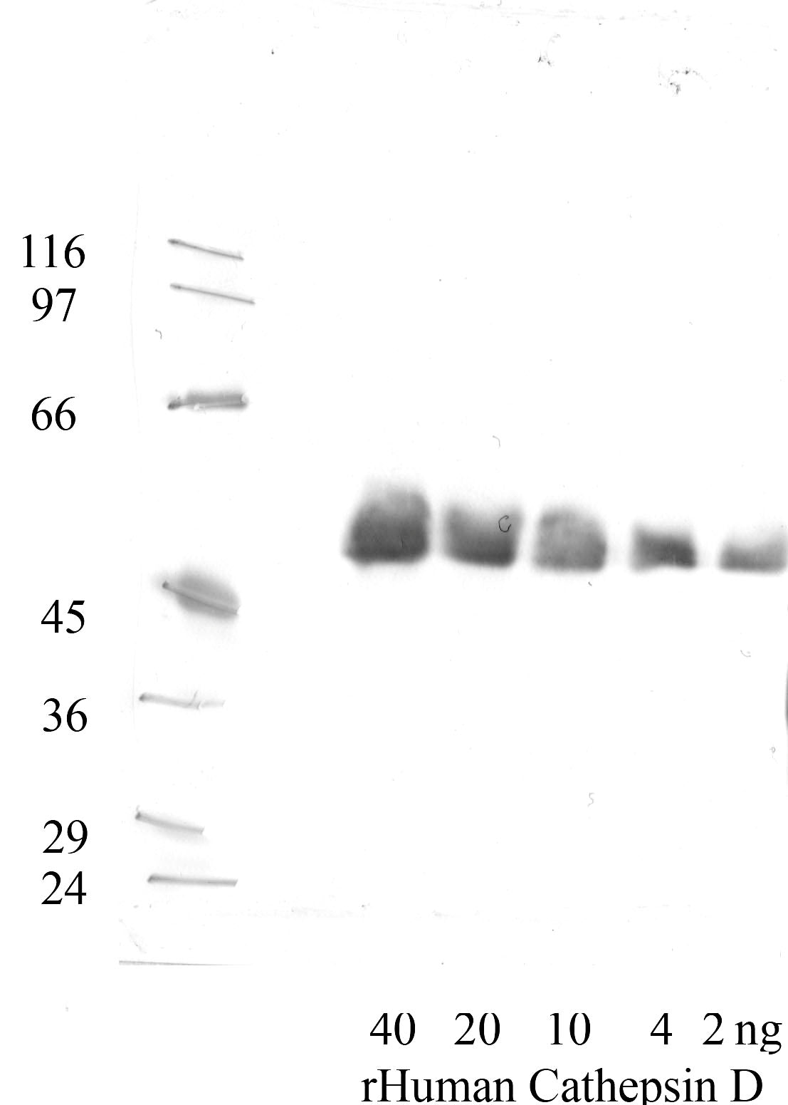 Cathepsin-D