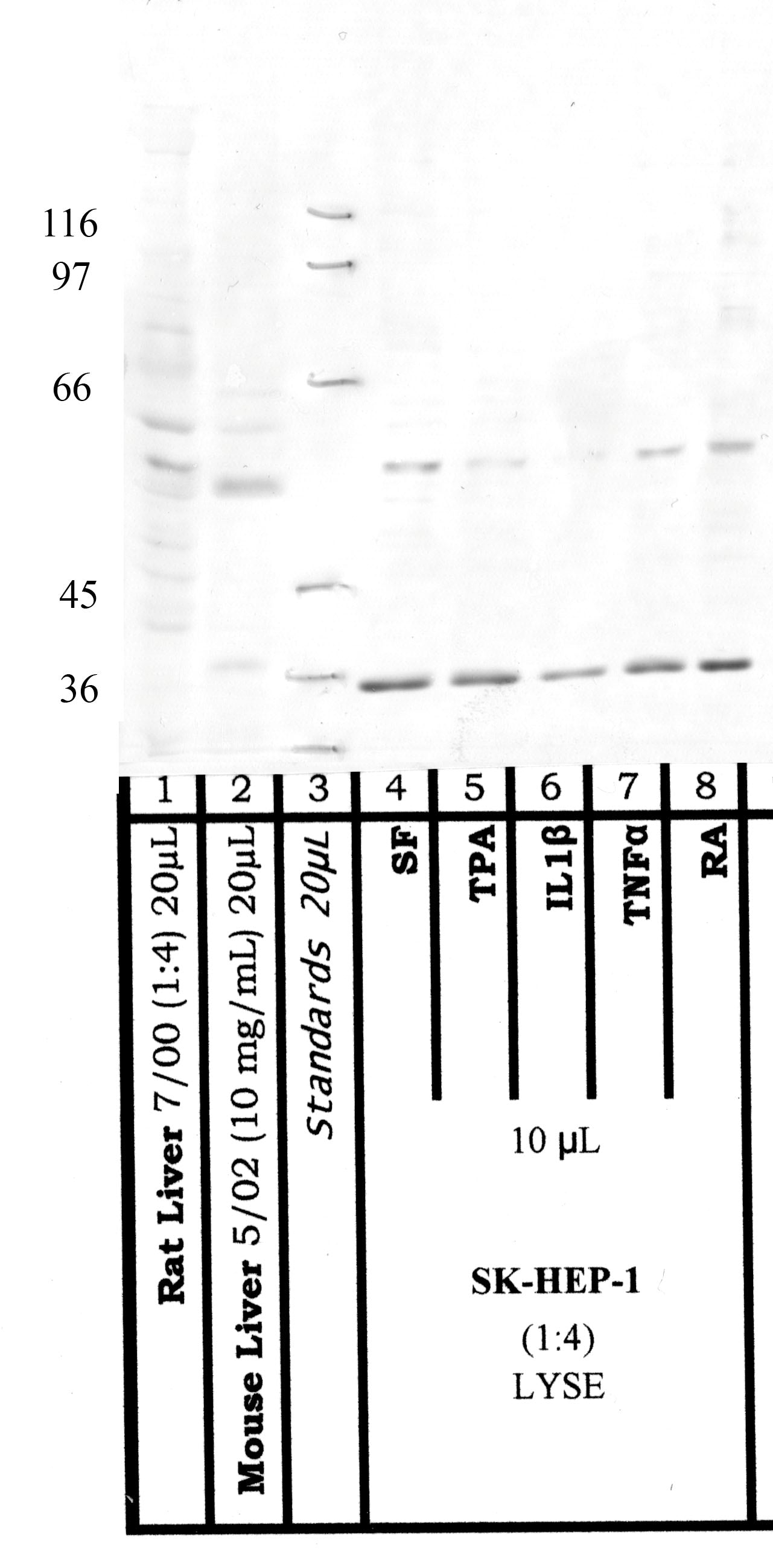 Site-1 Protease