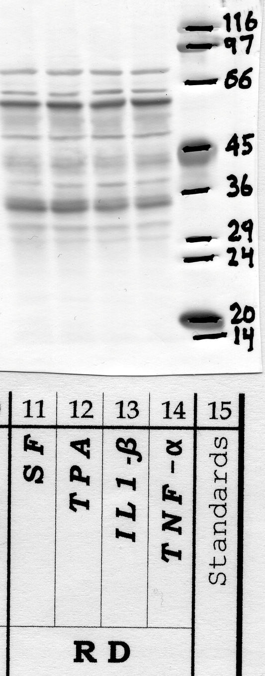 Calpain-3