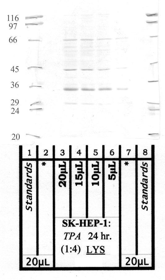 Calpain-S1