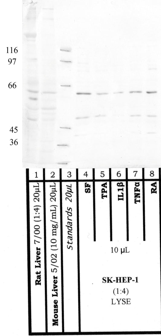 Site-1 Protease
