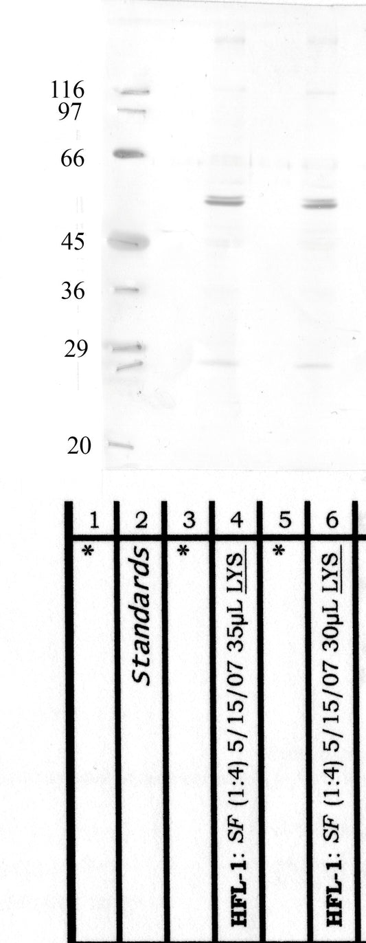 TMPRSS-11F