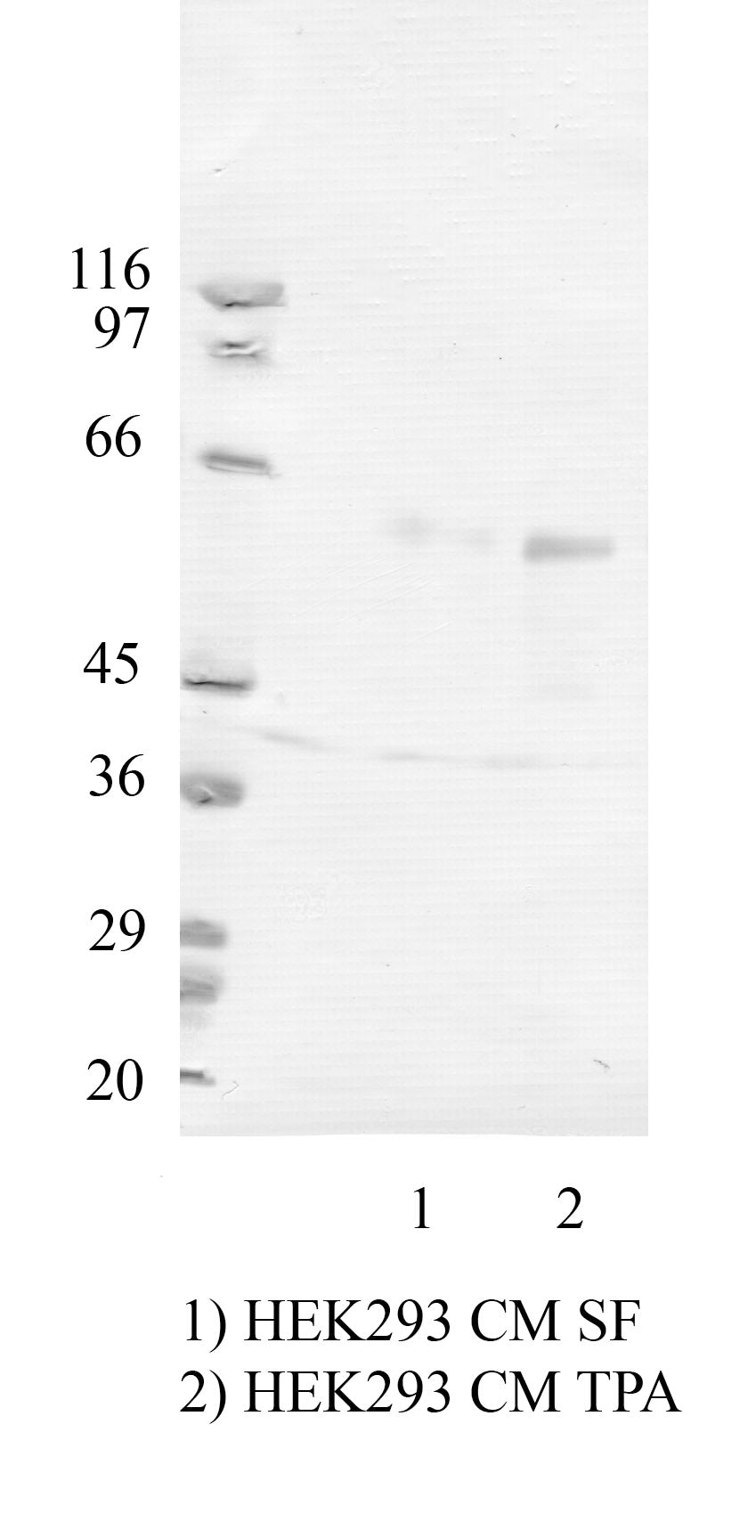 TMPRSS-3