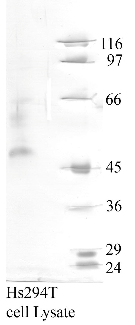 Cathepsin-W
