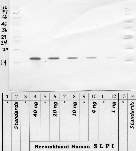 SLPI
