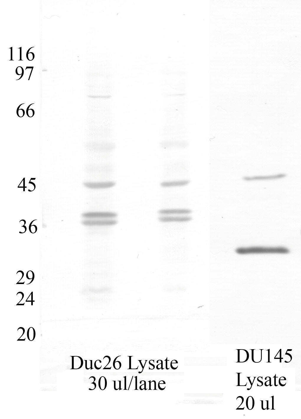 Serpin-B11