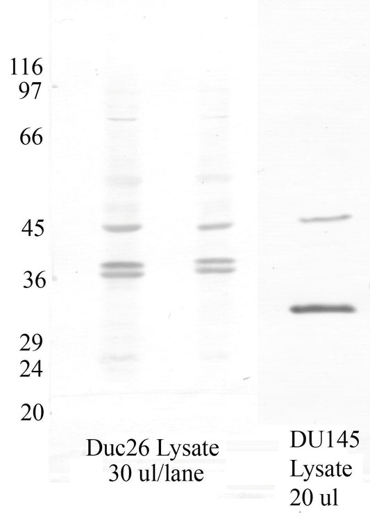 Serpin-B11