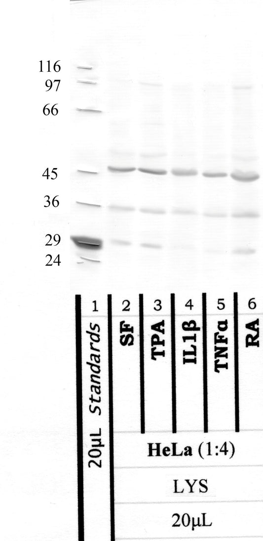 TMPRSS-11B