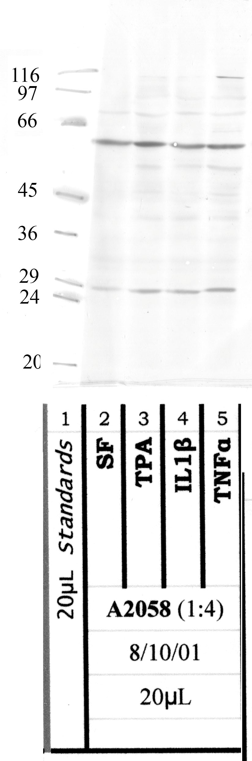 TMPRSS-11E
