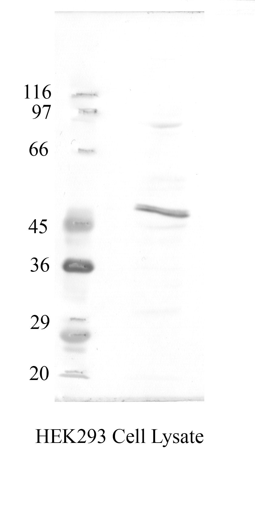 TMPRSS-2