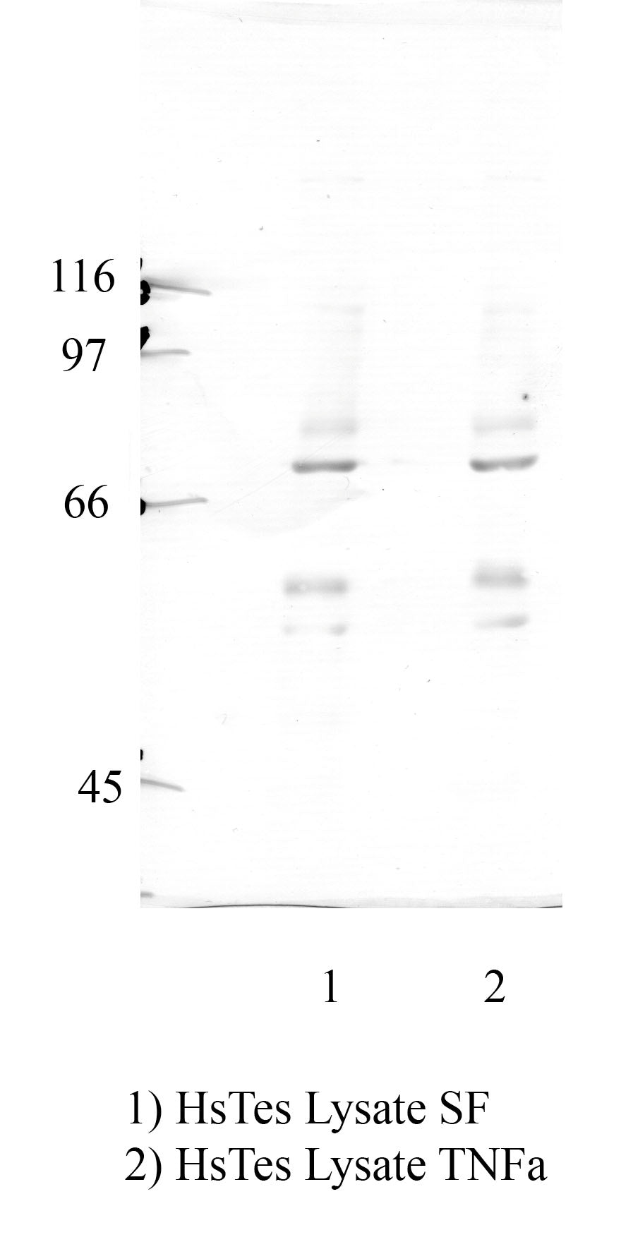 Calpain-11