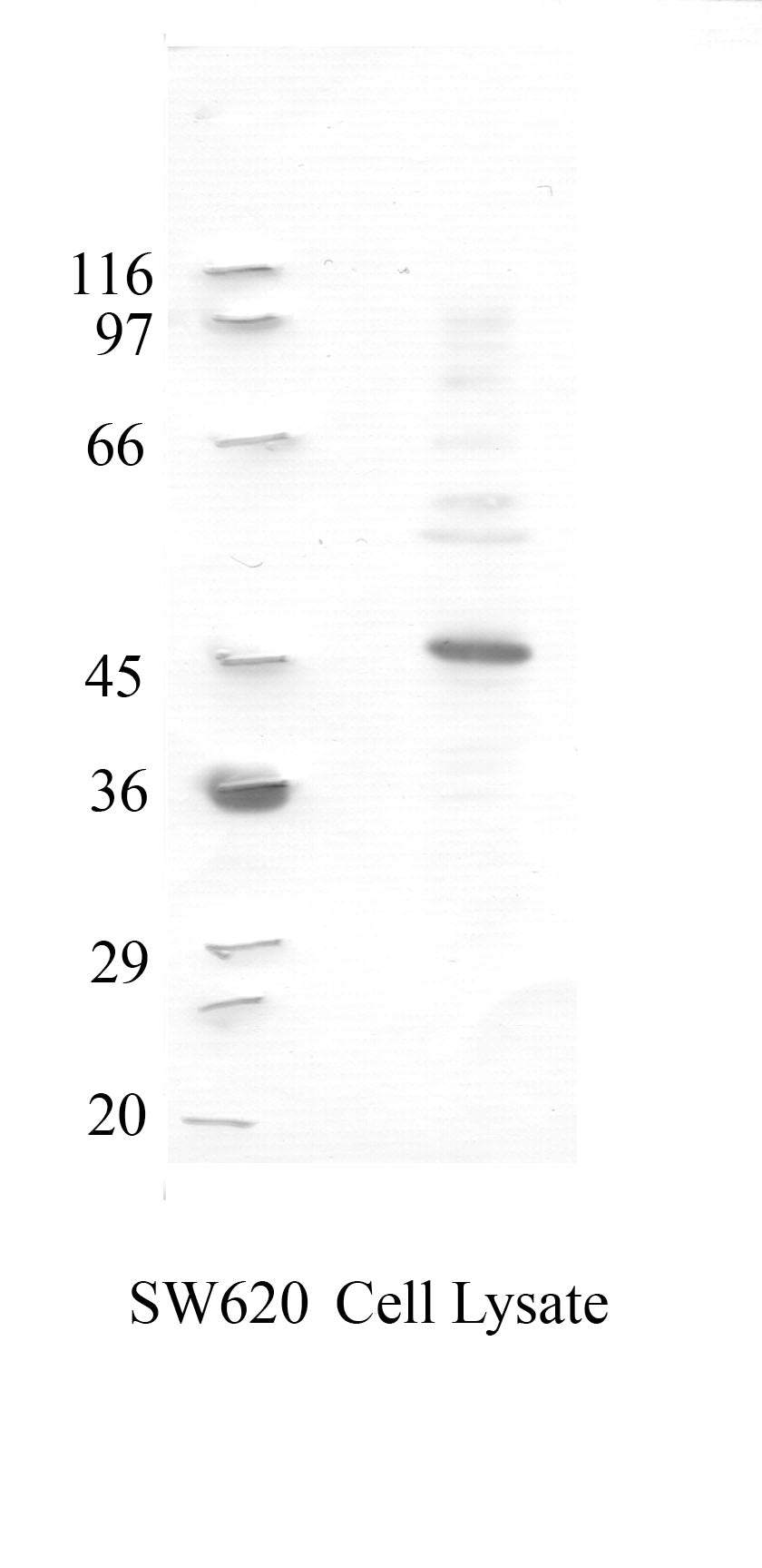 TMPRSS-2