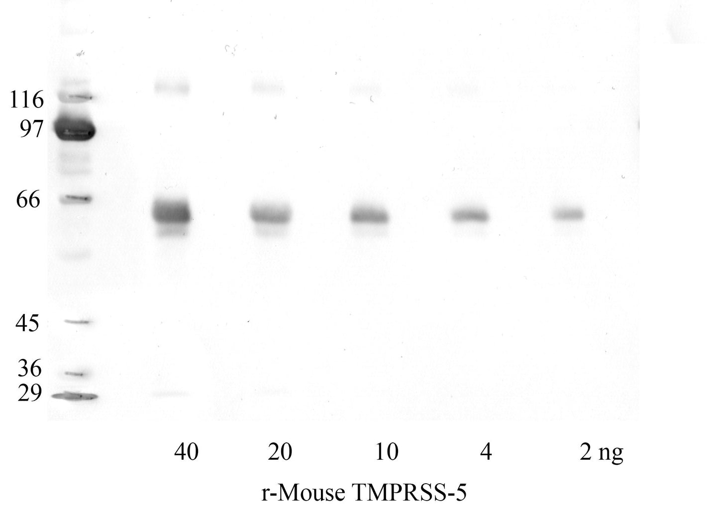 TMPRSS-5