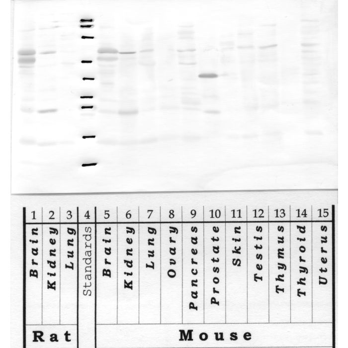 Kallikrein-12: Kallikrein loop — WB validation