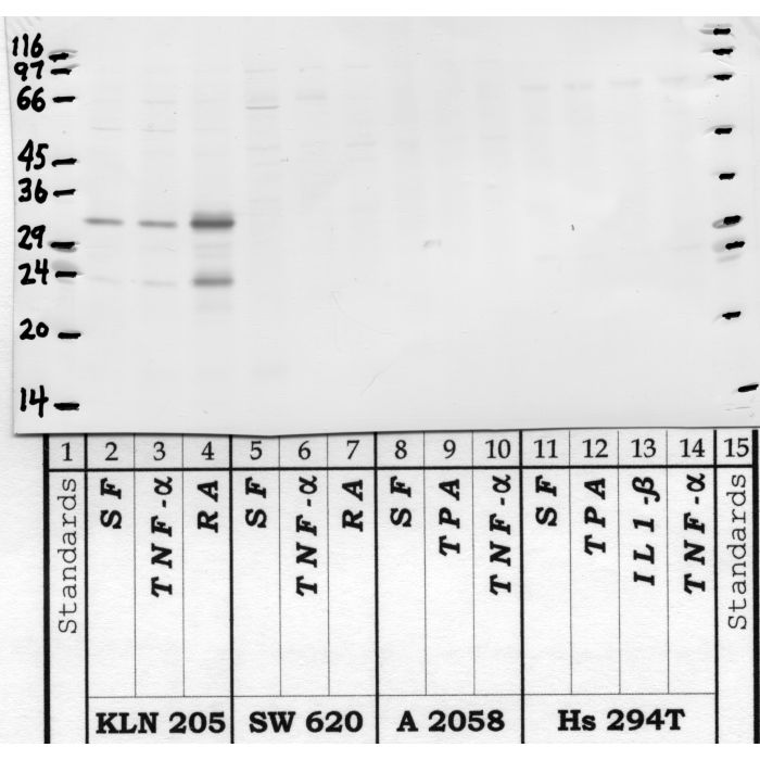 Kallikrein-15: Kallikrein loop — WB validation
