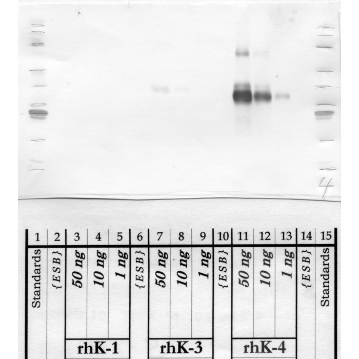 Kallikrein-4: Kallikrein loop — WB validation