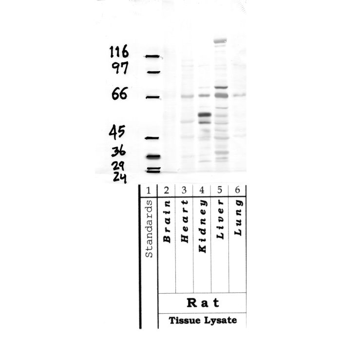 ADAMTS-15: Propeptide domain — WB validation