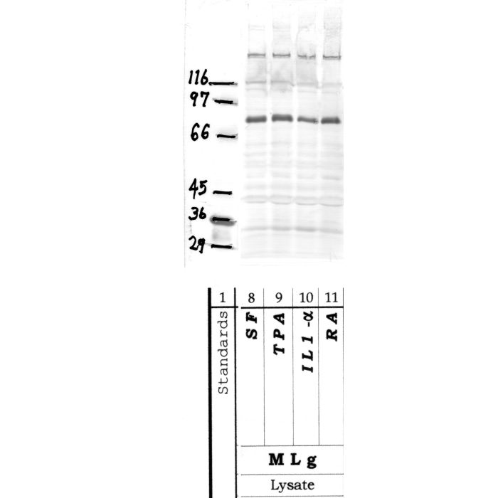 ADAMTS-16: Propeptide domain — WB validation