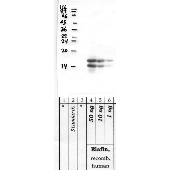 Elafin: Â middle of human Elafin — WB validation