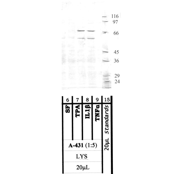 MMP-16: Hinge region — WB validation