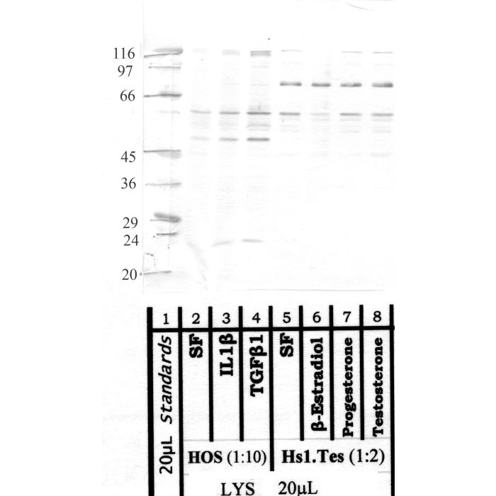 MMP-21H: Propeptide domain human MMP-21 — WB validation