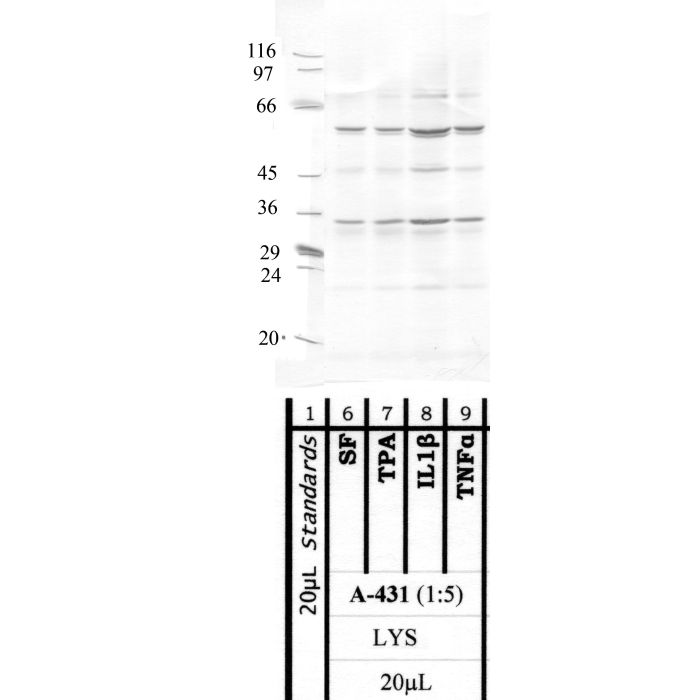 MMP-25: Hinge region — WB validation