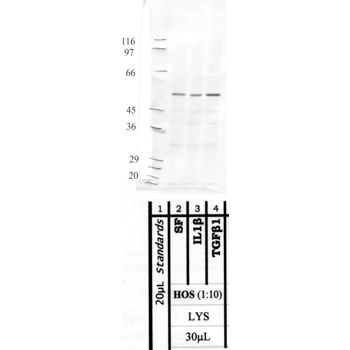 MMP-8: Hinge region — WB validation