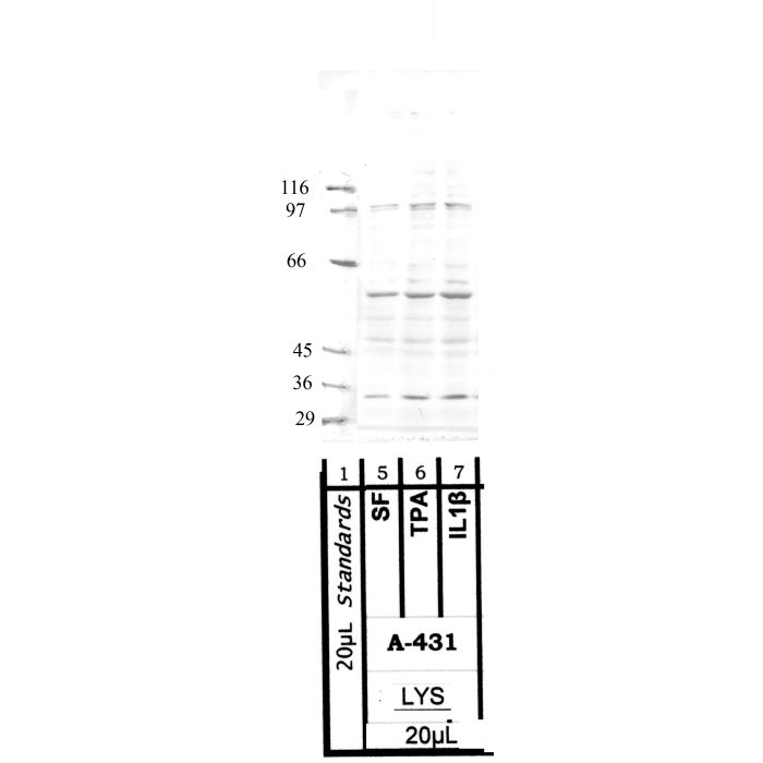 ADAMTS-8: Metalloproteinase domain — WB validation
