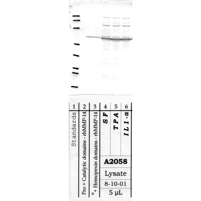 MMP-14: Â Aminoterminal end of active enzyme — WB validation