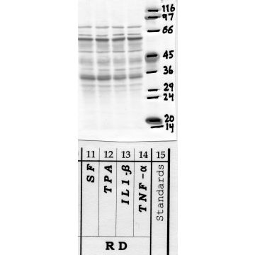 Anti-Calpain-3 Rabbit Polyclonal Antibody