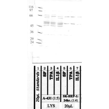 Calpain 9: Domain IV (EF-1) — WB validation