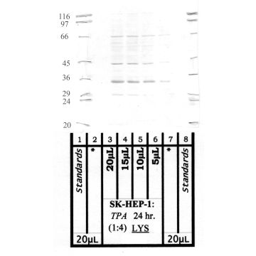 Calpain S1: Aminoterminal end Domain-V, Small subunit — WB validation