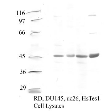 Cathepsin F: Propeptide domain — WB validation