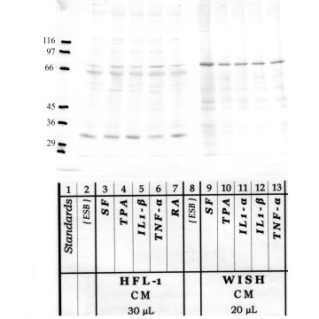 RECK: Amino end — WB validation