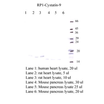 Anti-Cystatin-9 Rabbit Polyclonal Antibody