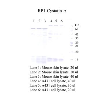 Anti-Cystatin-A Rabbit Polyclonal Antibody