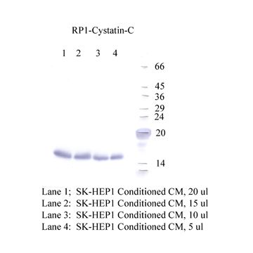 Anti-Cystatin-C Rabbit Polyclonal Antibody
