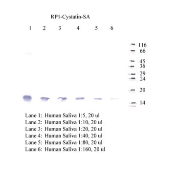Anti-Cystatin-SA Rabbit Polyclonal Antibody