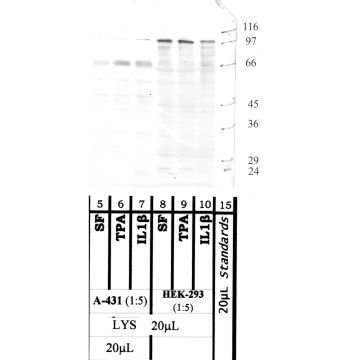 ADAM-10: Cytoplasmic domain — WB validation