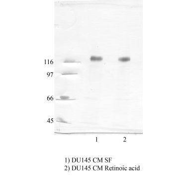 Anti-ADAM-22 Rabbit Polyclonal Antibody