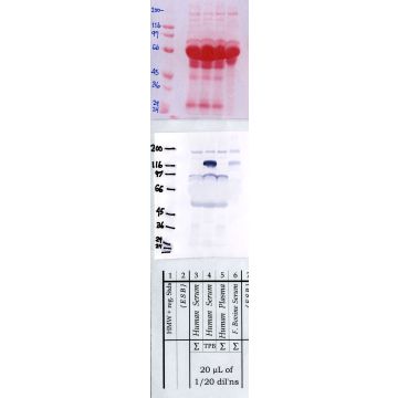 ADAMTS-13: propeptide — WB validation