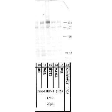 ADAMTS-1: Carboxyterminal end — WB validation