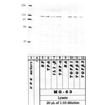 Anti-ADAMTS-2 Rabbit Polyclonal Antibody